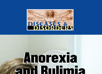 Anorexia and Bulimia