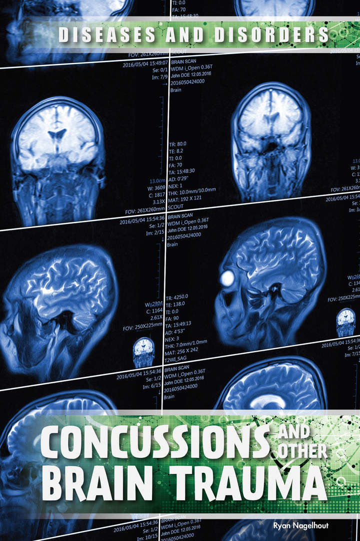 Concussions and Other Brain Trauma