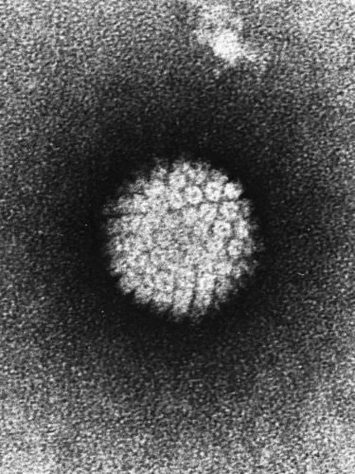 Un virus que causa cáncer