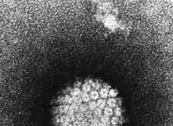 Un virus que causa cáncer