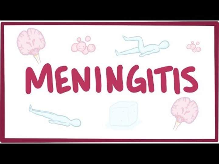 Meningitis: causas, síntomas, diagnóstico, tratamiento, patología.