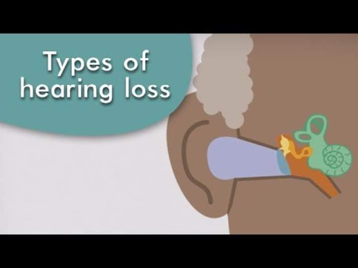 Tipos de pérdida auditiva