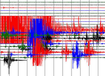 Medición de la magnitud del terremoto