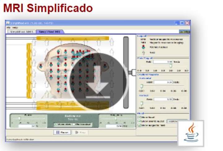 MRI Simplificado